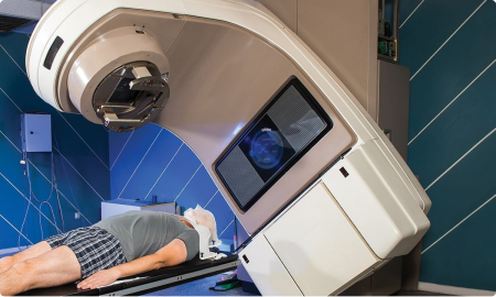 Radiotherapy For Cancer Treatment